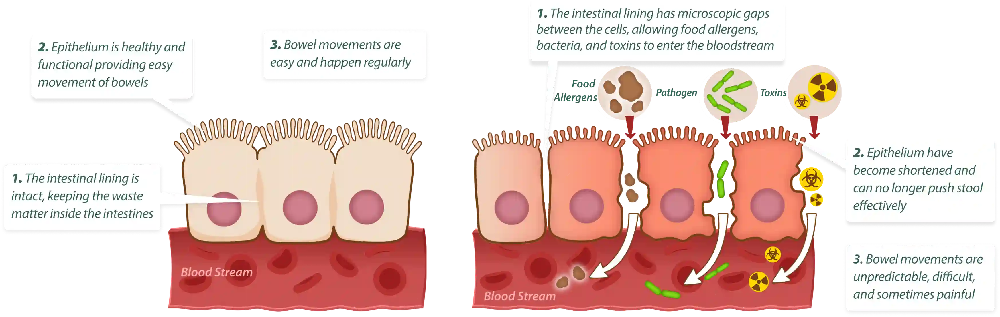 How Emma Relief works – 3-step gut cleansing and healing process