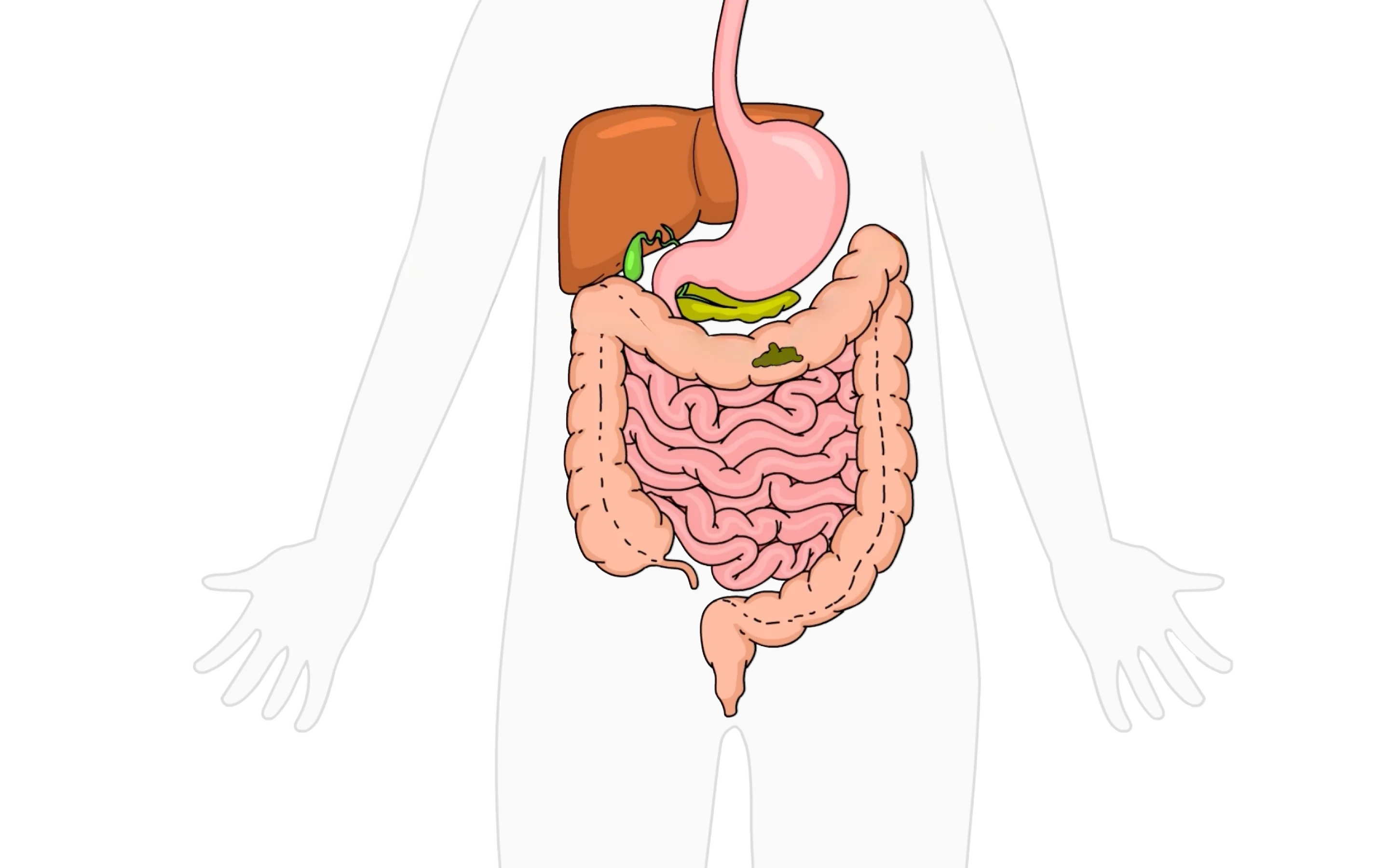 Emma Relief gut health video illustration